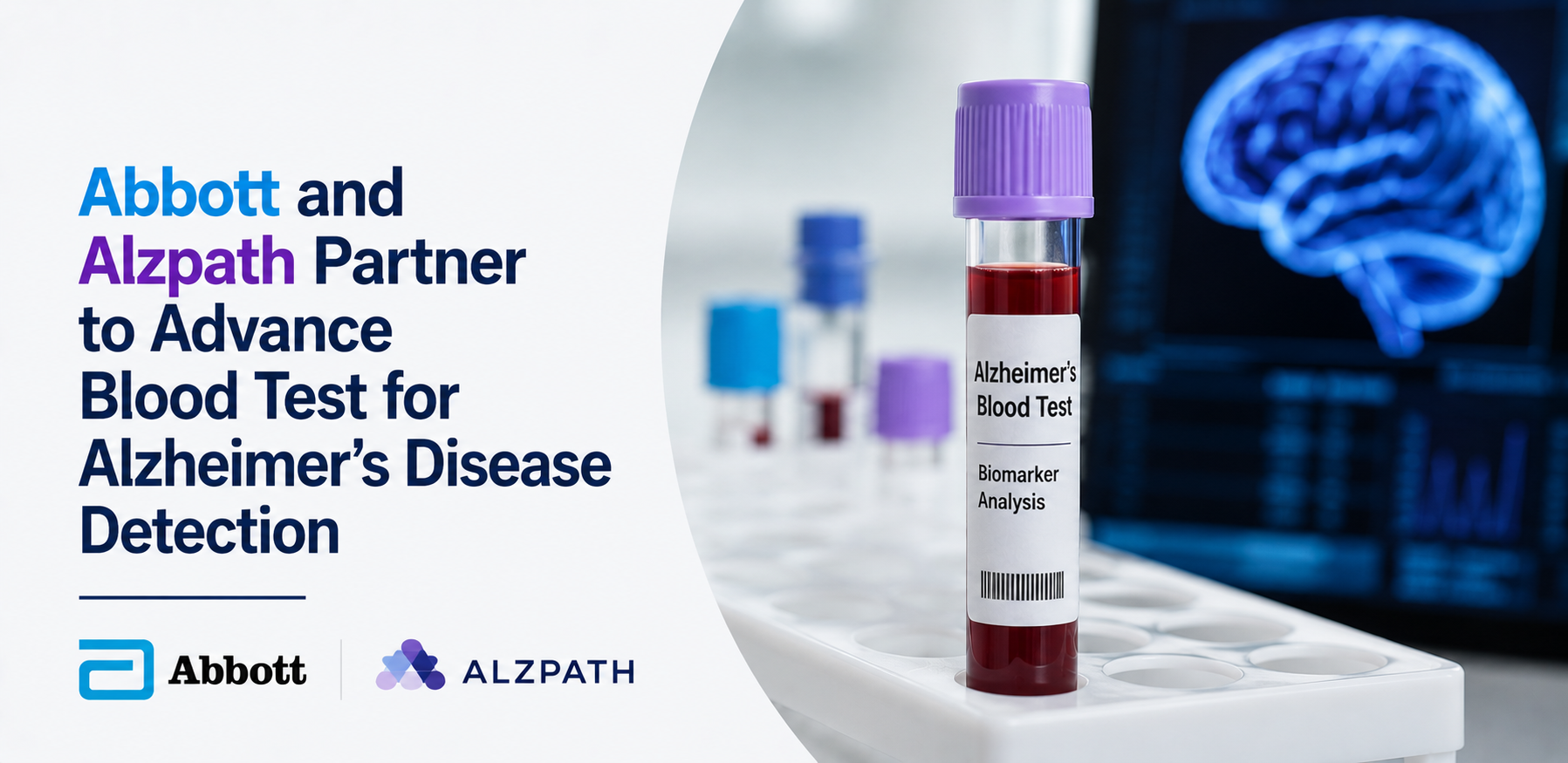 Abbott and Alzpath Partner to Advance Blood Test for Alzheimer's Disease Detection
