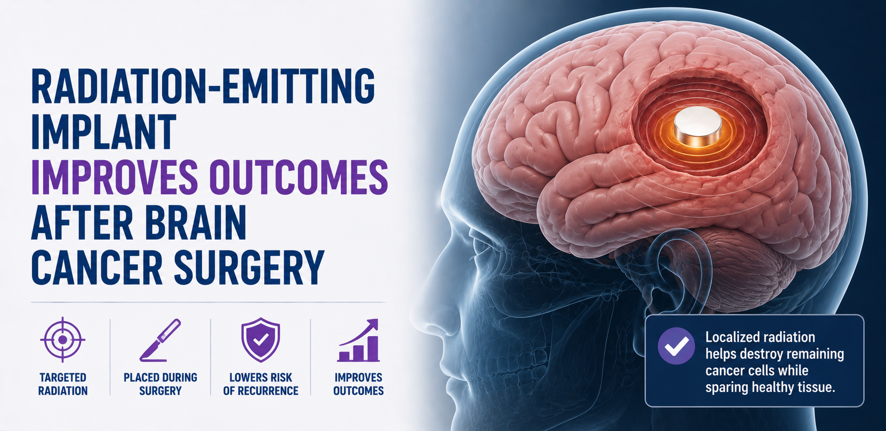Radiation-Emitting Implant Improves Outcomes After Brain Cancer Surgery