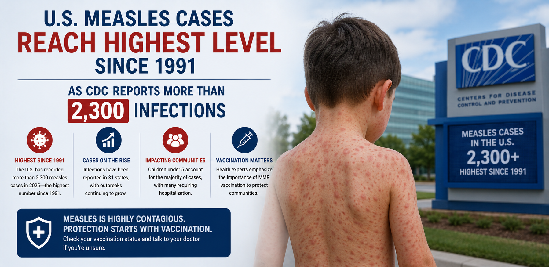 U.S. Measles Cases Reach Highest Level Since 1991 as CDC Reports More Than 2,300 Infections